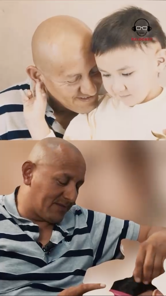 Bald man in a striped polo with a child in a split-screen family scene, with a Baldcast logo in the upper corner.