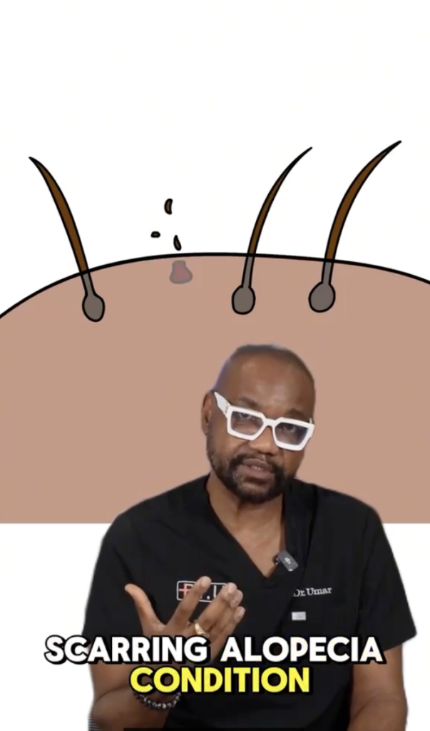 Dr. U in black scrubs speaking in front of a hair follicle illustration.