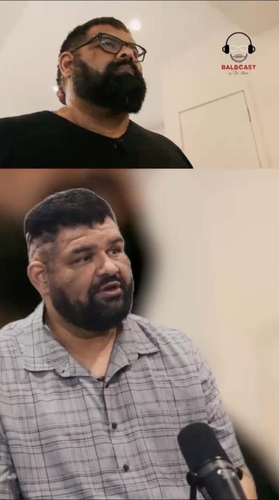 Two vertically stacked frames show John during a Baldcast interview, including a close view of him speaking into a microphone.