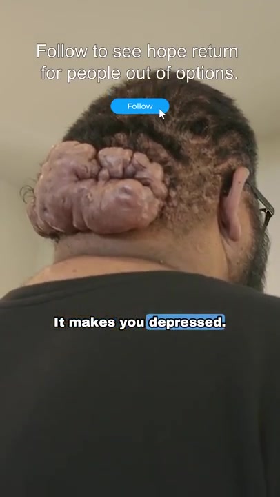When Looking Hurts The Truth Behind John’s Scalp Bumps