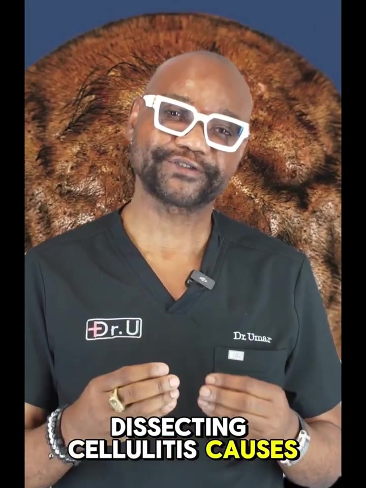 Dissecting Cellulitis: The Inflammation You May Not SeeYoutube