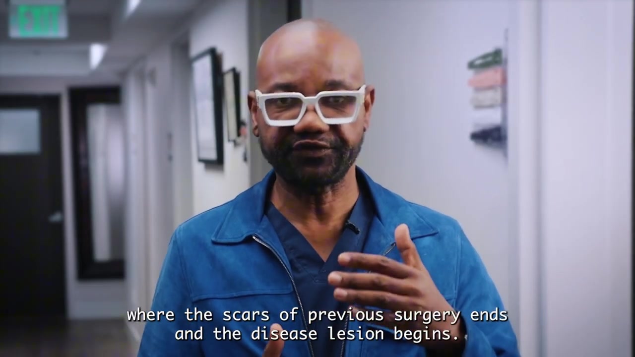 One Last Shot at Treating Cicatricial Folliculitis Part 2 | Anwar’s Journey