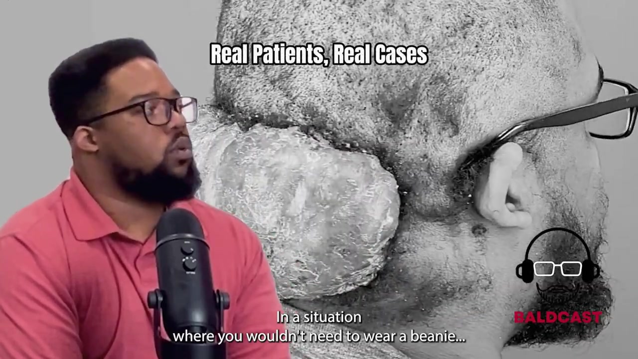 When Saying No Felt Safer, A Scalp Disorder Story | Adrian’s Journey