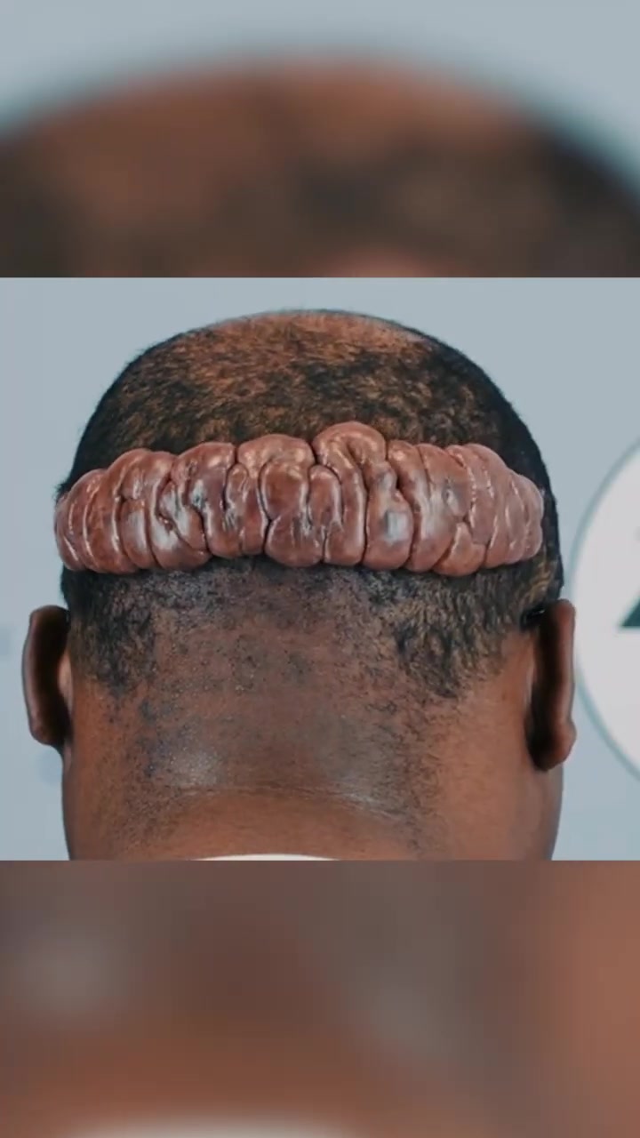Marcus Is Ready to Say Goodbye to “Mr. Brain” 🧠