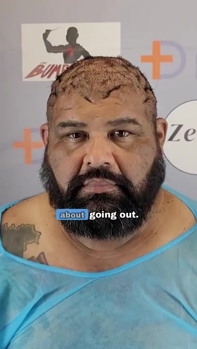 How Giant Scalp Keloids Pushed John To The Edge