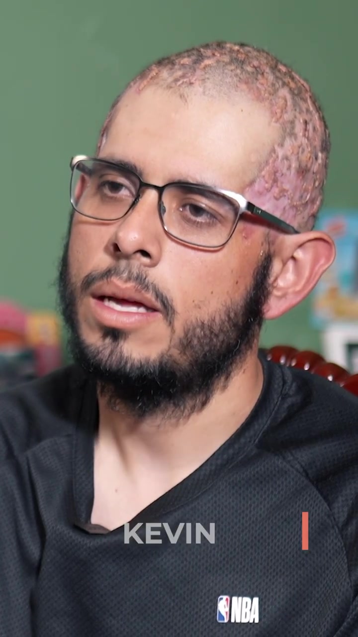 Severe Dissecting Cellulitis: Kevin’s Story Begins