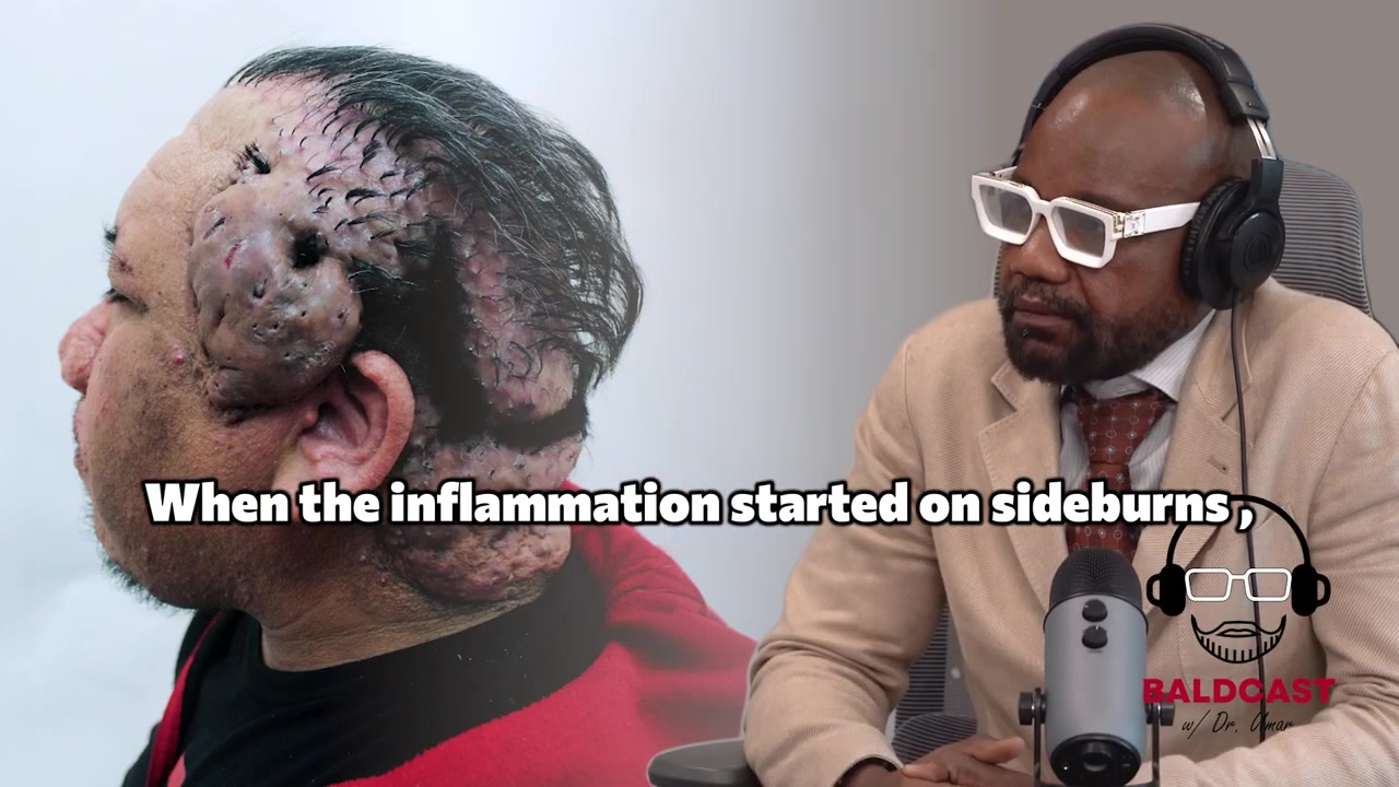 How a Scalp Disease Turned Glasses Into Pain and Sleep Into a Calculation