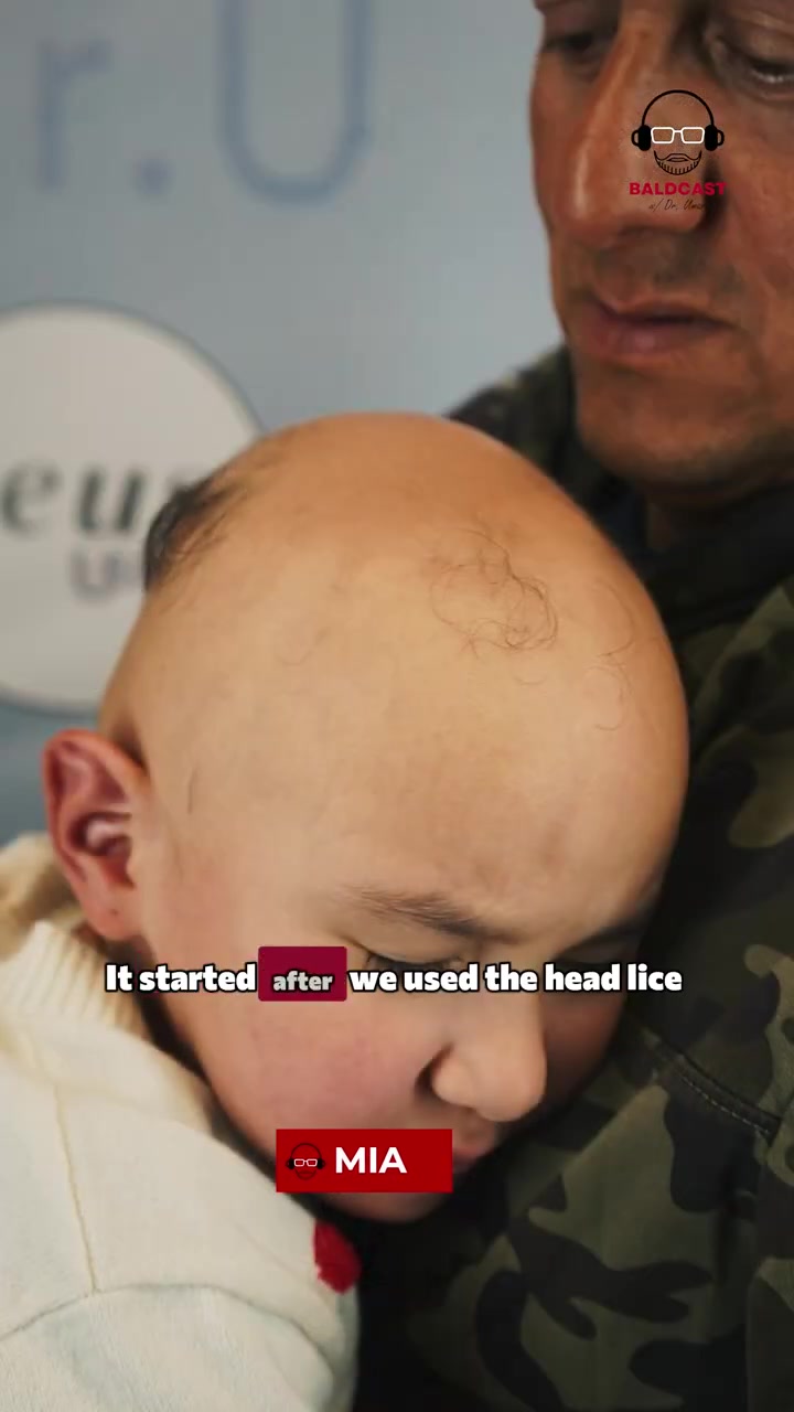 Mia's Alopecia Totalis Story Begins | Childhood Hair Loss