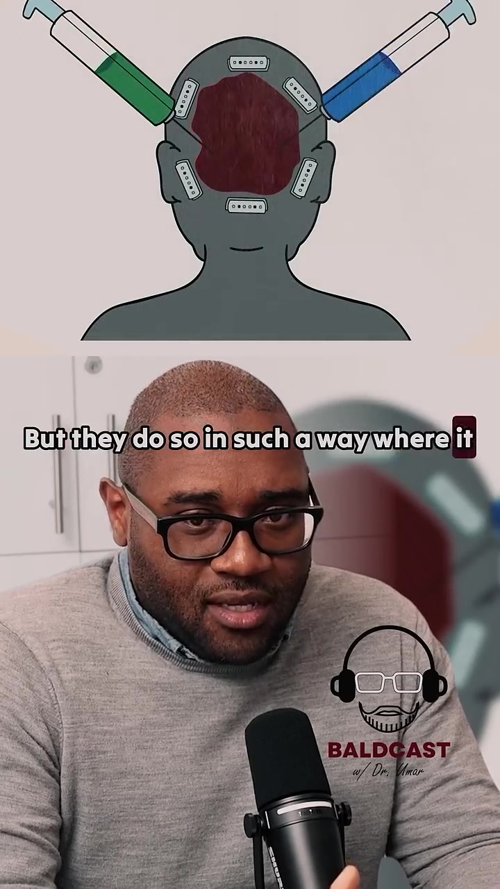 The Tension Suture Story | Anwar's Baldcast Chapter 17 Part 1