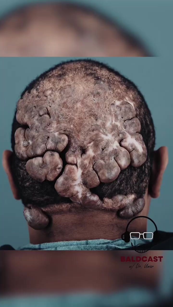 Chapter 1 of Baldcast Ep 4: Anwar.