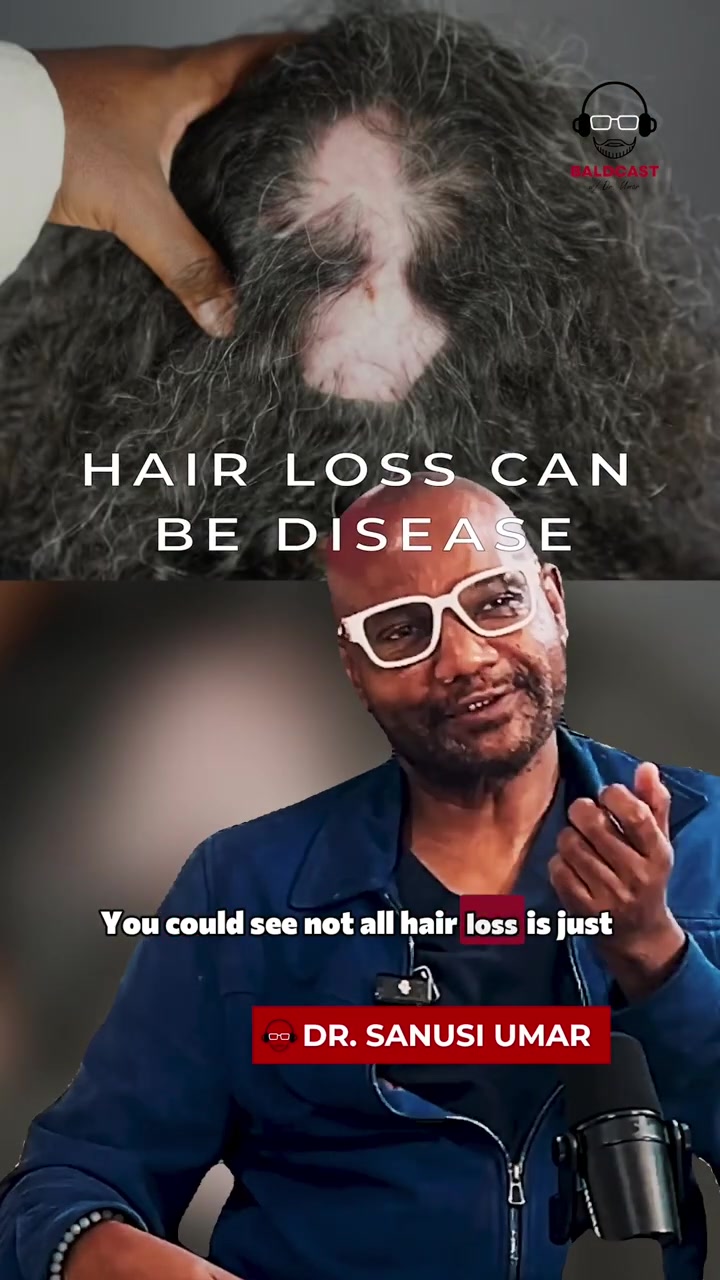 Alopecia Scarring Is Not Vanity: When Treatment Pain Becomes Unbearable | Maria Landeros