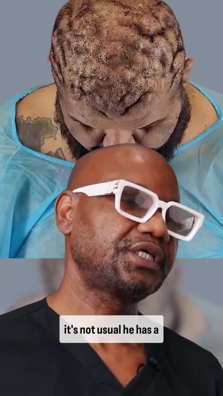 John's scalp revealed much more than painful bumps.