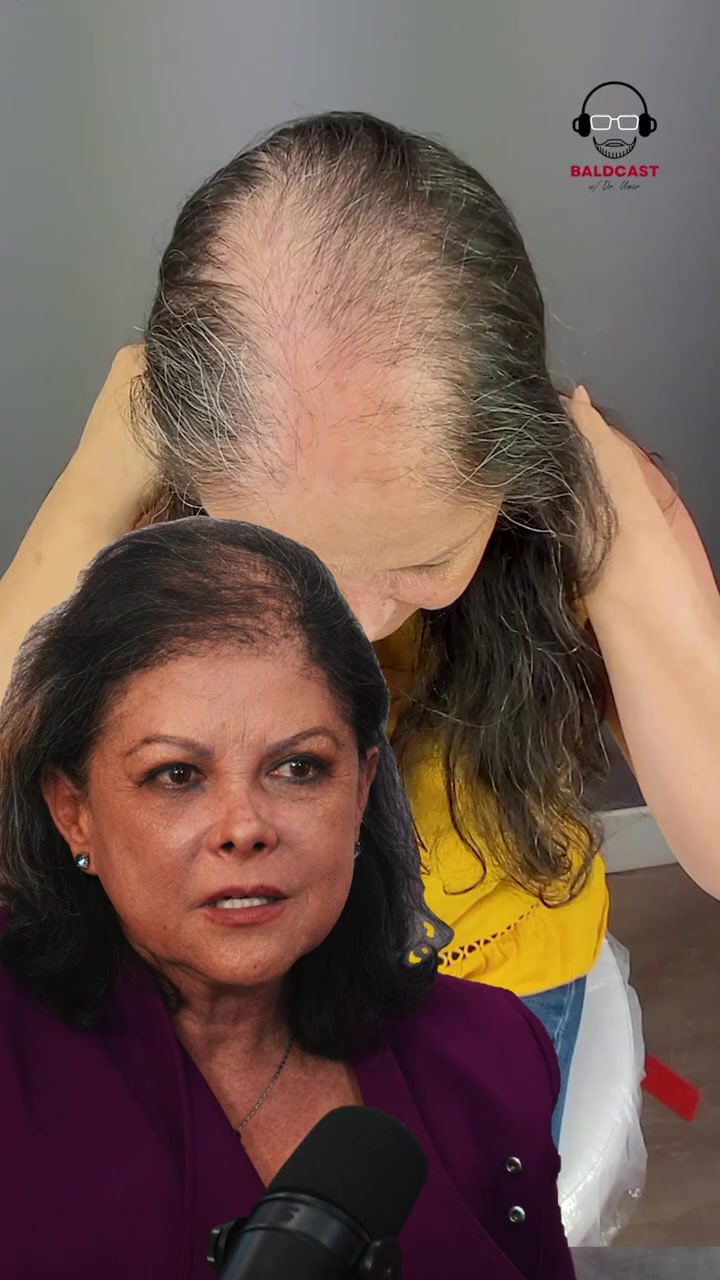 The Cost of Waiting With Inflammatory Scarring Alopecia and Perifollicular Scale | Maria's Story