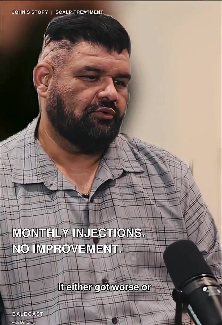 Scalp Bumps on Back of Head: Why John Stopped Treatment | AKN Story